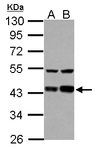 Sample (30 ug of whole cell lysate) A: HeLa B: HepG2 10% SDS PAGE LRPAP1 antibody diluted at 1:1000