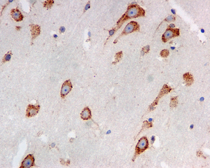 IHC of paraffin-embedded human brain tissue using anti-LRPAP1 antibody.