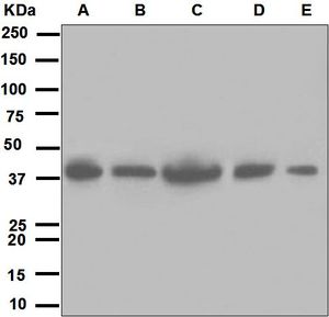 Western blot analysis on (A) fetal kidney, (B) 293T, (C) A549, (D) BxPC-3, and (E) NCCIT lysates using anti-LRPAP1 antibody.