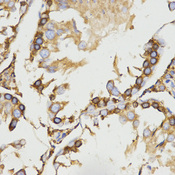 Immunohistochemistry of paraffin-embedded rat testis tissue using LRPAP1 antibody at dilution of 1:200 (x400 lens)