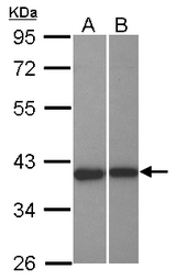 Sample (30 ug of whole cell lysate) A: NT2D1 B: U87-MG 10% SDS PAGE LRRC23 antibody diluted at 1:1000
