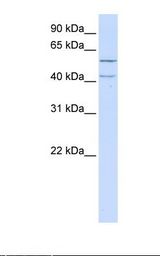 721_B cell lysate. Antibody concentration: 1.0 ug/ml. Gel concentration: 12%.