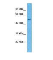 Western blot of Human Esophagus Tumor. LRRC14 antibody dilution 1.0 ug/ml.