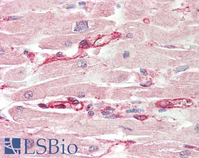 Human, Heart: Formalin-Fixed Paraffin-Embedded (FFPE)