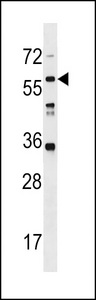 LRRC14B Antibody western blot of WiDr cell line lysates (35 ug/lane). The LRRC14B antibody detected the LRRC14B protein (arrow).