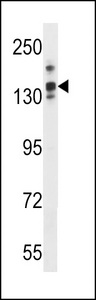 LRRC16A Antibody western blot of mouse stomach tissue lysates (35 ug/lane). The LRRC16A antibody detected the LRRC16A protein (arrow).