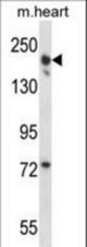 LRRC16B Antibody western blot of mouse heart tissue lysates (35 ug/lane). The LRRC16B antibody detected the LRRC16B protein (arrow).