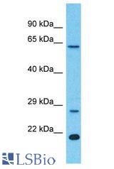 LRRC18 antibody Western Blot of Colorectal Tumor. Antibody dilution: 1 ug/ml.