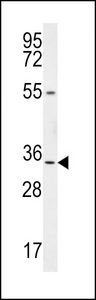 LRC18 Antibody western blot of mouse bladder tissue lysates (35 ug/lane). The LRC18 antibody detected the LRC18 protein (arrow).