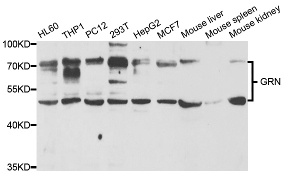 Western blot analysis of extracts of various cell lines, using GRN antibody.