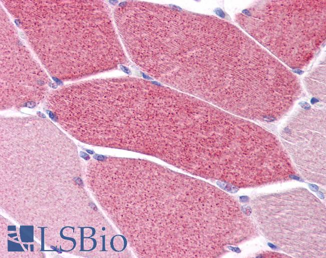 Anti-LRRC19 antibody IHC of human skeletal muscle. Immunohistochemistry of formalin-fixed, paraffin-embedded tissue after heat-induced antigen retrieval. Antibody LS-B5078 concentration 5 ug/ml.