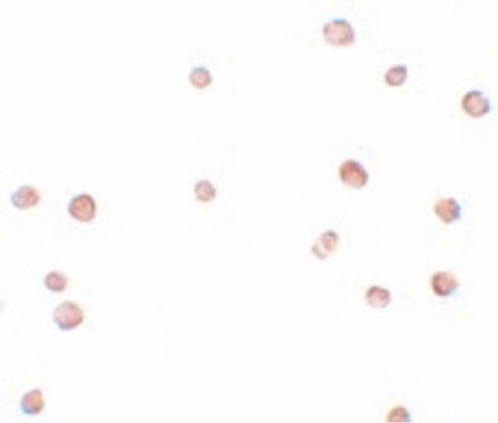 Immunocytochemistry of LRCC19 in K562 cells with LRCC19 antibody at 2.5 ug/ml.