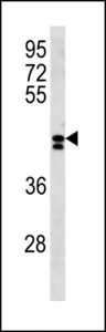 LRRC2 Antibody western blot of NCI-H460 cell line lysates (35 ug/lane). The LRRC2 antibody detected the LRRC2 protein (arrow).