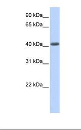 Fetal muscle lysate. Antibody concentration: 1.0 ug/ml. Gel concentration: 12%.