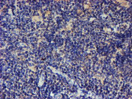 IHC of paraffin-embedded Human lymphoma tissue using anti-LRRC25 mouse monoclonal antibody.