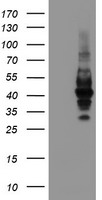 HEK293T cells were transfected with the pCMV6-ENTRY control (Left lane) or pCMV6-ENTRY LRRC25 (Right lane) cDNA for 48 hrs and lysed. Equivalent amounts of cell lysates (5 ug per lane) were separated by SDS-PAGE and immunoblotted with anti-LRRC25.