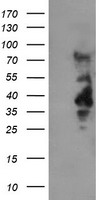 HEK293T cells were transfected with the pCMV6-ENTRY control (Left lane) or pCMV6-ENTRY LRRC25 (Right lane) cDNA for 48 hrs and lysed. Equivalent amounts of cell lysates (5 ug per lane) were separated by SDS-PAGE and immunoblotted with anti-LRRC25.