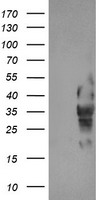 HEK293T cells were transfected with the pCMV6-ENTRY control (Left lane) or pCMV6-ENTRY LRRC25 (Right lane) cDNA for 48 hrs and lysed. Equivalent amounts of cell lysates (5 ug per lane) were separated by SDS-PAGE and immunoblotted with anti-LRRC25.