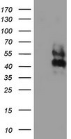 HEK293T cells were transfected with the pCMV6-ENTRY control (Left lane) or pCMV6-ENTRY LRRC25 (Right lane) cDNA for 48 hrs and lysed. Equivalent amounts of cell lysates (5 ug per lane) were separated by SDS-PAGE and immunoblotted with anti-LRRC25.