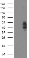 HEK293T cells were transfected with the pCMV6-ENTRY control (Left lane) or pCMV6-ENTRY LRRC25 (Right lane) cDNA for 48 hrs and lysed. Equivalent amounts of cell lysates (5 ug per lane) were separated by SDS-PAGE and immunoblotted with anti-LRRC25.