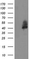 HEK293T cells were transfected with the pCMV6-ENTRY control (Left lane) or pCMV6-ENTRY LRRC25 (Right lane) cDNA for 48 hrs and lysed. Equivalent amounts of cell lysates (5 ug per lane) were separated by SDS-PAGE and immunoblotted with anti-LRRC25.