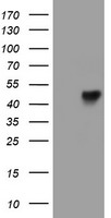 HEK293T cells were transfected with the pCMV6-ENTRY control (Left lane) or pCMV6-ENTRY LRRC25 (Right lane) cDNA for 48 hrs and lysed. Equivalent amounts of cell lysates (5 ug per lane) were separated by SDS-PAGE and immunoblotted with anti-LRRC25.