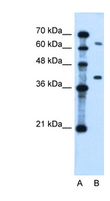 LRRC26 antibody LS-C40489 Western blot of Jurkat lysate.