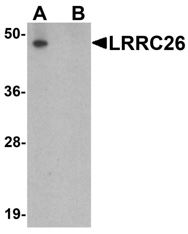 Western blot analysis of LRRC26 in human prostate tissue lysate with LRRC26 antibody at 0.5 ug/ml in (A) the absence and (B) the presence of blocking peptide.