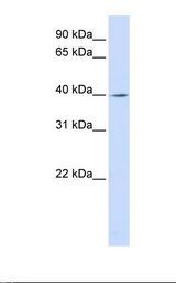 Fetal brain lysate. Antibody concentration: 1.0 ug/ml. Gel concentration: 12%.