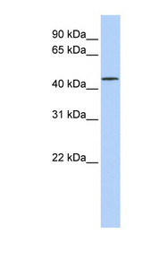 LRRC28 antibody LS-C102450 Western blot of Jurkat lysate.