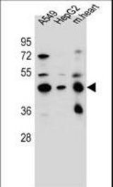 LRRC28 Antibody western blot of A549,HepG2 cell line and mouse heart tissue lysates (35 ug/lane). The LRRC28 antibody detected the LRRC28 protein (arrow).