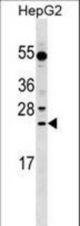 LRRC29 Antibody western blot of HepG2 cell line lysates (35 ug/lane). The LRRC29 antibody detected the LRRC29 protein (arrow).