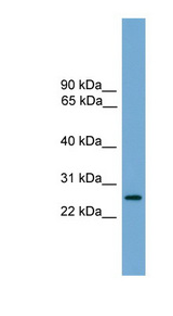 LRRC3 antibody LS-C116314 Western blot of Fetal Brain lysate.