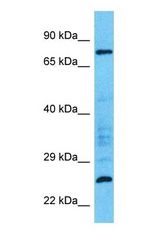 Western blot of LRRC36 Antibody with human HT1080 Whole Cell lysate.