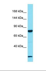 Western blot of Human Fetal Lung. LRRC37A antibody dilution 1.0 ug/ml.