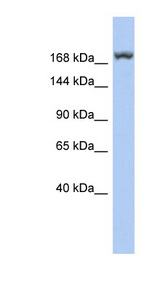 LRRC37A3 antibody LS-C111788 Western blot of Fetal Lung lysate.