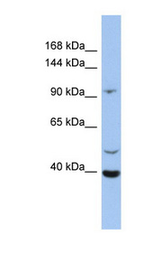 LRRC37B antibody LS-C111260 Western blot of OVCAR-3 cell lysate.
