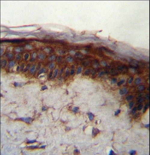 LRRC37B Antibody immunohistochemistry of formalin-fixed and paraffin-embedded human skin tissue followed by peroxidase-conjugated secondary antibody and DAB staining.