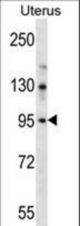 LRRC37B Antibody western blot of human normal Uterus tissue lysates (35 ug/lane). The LRRC37B antibody detected the LRRC37B protein (arrow).