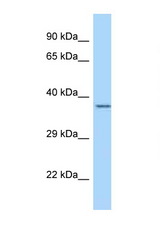 LRRC39 antibody LS-C145365 Western blot of 435S Cell lysate. Antibody concentration 1 ug/ml.