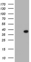 HEK293T cells were transfected with the pCMV6-ENTRY control (Left lane) or pCMV6-ENTRY LRRC39 (Right lane) cDNA for 48 hrs and lysed. Equivalent amounts of cell lysates (5 ug per lane) were separated by SDS-PAGE and immunoblotted with anti-LRRC39.