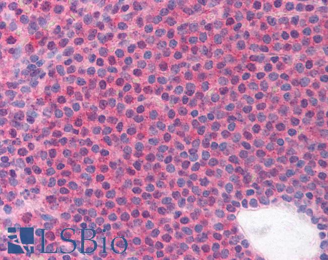 Anti-LRRC3B / LRP15 antibody IHC of human spleen. Immunohistochemistry of formalin-fixed, paraffin-embedded tissue after heat-induced antigen retrieval. Antibody LS-B880 concentration 5 ug/ml.