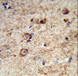 Formalin-fixed and paraffin-embedded human brain tissue reacted with LRRC4 Antibody , which was peroxidase-conjugated to the secondary antibody, followed by DAB staining. This data demonstrates the use of this antibody for immunohistochemistry; clinical relevance has not been evaluated.
