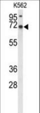 Western blot of LRRC4 Antibody in K562 cell line lysates (35 ug/lane). LRRC4 (arrow) was detected using the purified antibody.