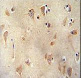 LRC40 antibody immunohistochemistry of formalin-fixed and paraffin-embedded human brain tissue followed by peroxidase-conjugated secondary antibody and DAB staining.