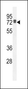 LRC40 Antibody western blot of HepG2 cell line lysates (35 ug/lane). The LRC40 antibody detected the LRC40 protein (arrow).