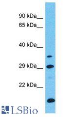 LRRC46 antibody Western Blot of ACHN. Antibody dilution: 1 ug/ml.
