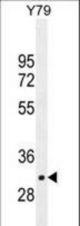 LRRC46 Antibody western blot of Y79 cell line lysates (35 ug/lane). The LRRC46 antibody detected the LRRC46 protein (arrow).