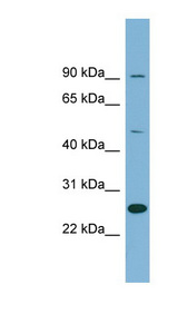 LRRC49 antibody LS-C107983 Western blot of HepG2 cell lysate.