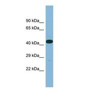 Western blot of Human Fetal Heart. LRRC49 antibody dilution 1.0 ug/ml.
